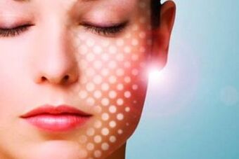 Laser non-abrasive skin rejuvenation
