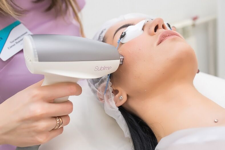 Laser skin rejuvenation procedure